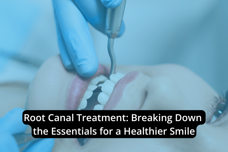 Close-up of a dentist performing a root canal treatment on a patient's teeth, with gloved hands and dental instruments visible. The text overlay reads, "Essentials of Root Canal Treatment: Breaking Down the Steps for a Healthier Smile.