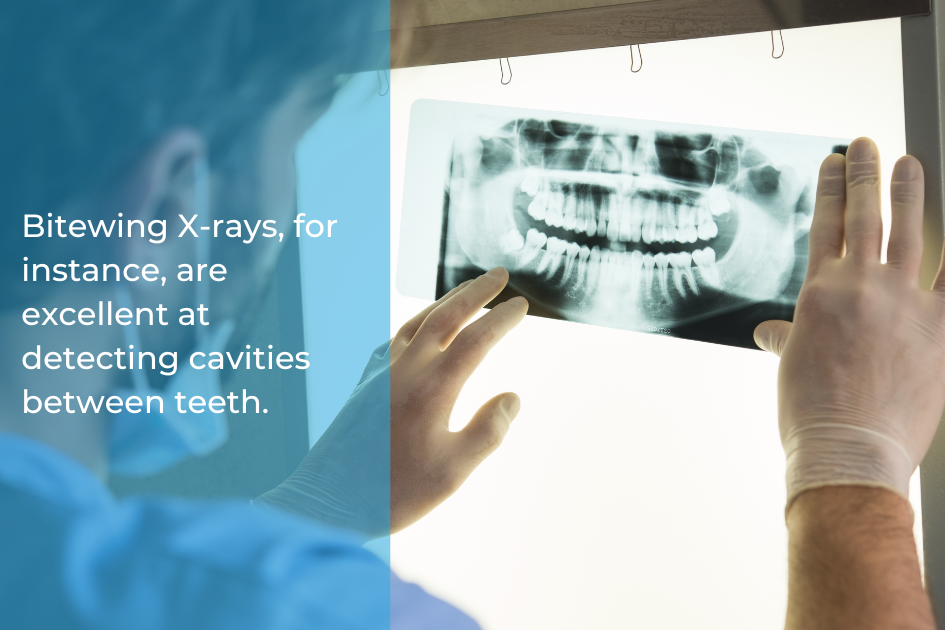 A dentist examines a dental X-ray on a lightbox while the text highlights the effectiveness of bitewing X-rays during a routine dental checkup for detecting cavities between teeth.