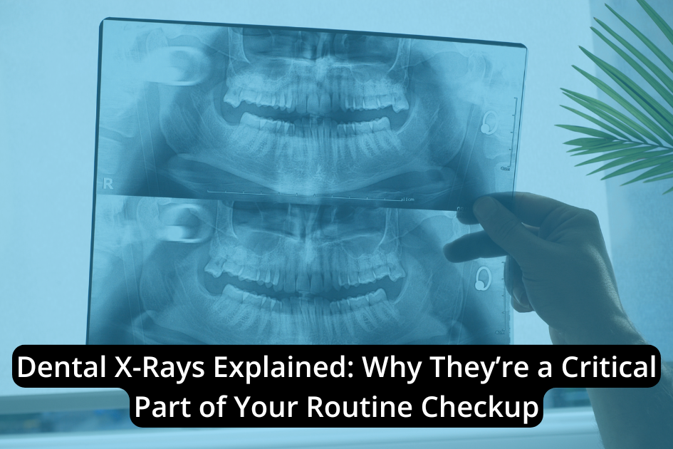 Hand holding dental X-ray films against a light source next to a plant. Text reads: "Dental X-Rays: A Critical Part of Your Routine Checkup.