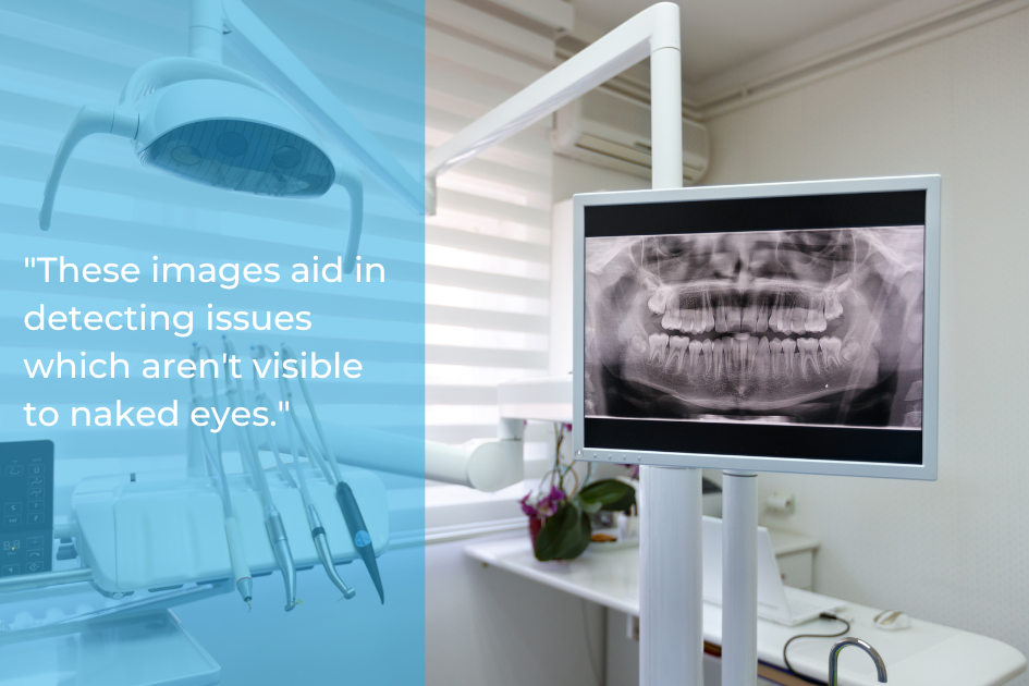 A dental office showcases a critical part of oral health: an X-ray image of teeth on the screen, accompanied by dental tools and a quote emphasizing the importance of detecting unseen issues during your routine checkup.